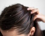 Grzybica skóry głowy: diagnostyka i skuteczne metody leczenia